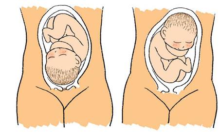 母乳检测仪之胎儿不正的原因及预防措施
