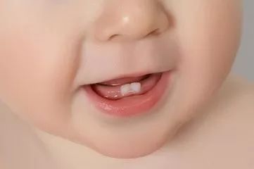 超声母乳检测仪厂家宝宝长牙时有哪些事情需求特别留意